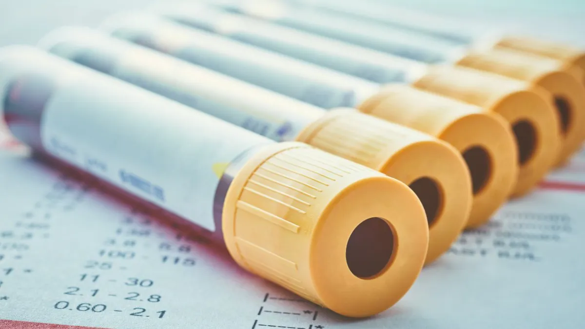 Androstenediona: Desvendando sua importância e o procedimento do exame