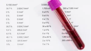 Hemograma completo: descubra seu papel vital na saúde