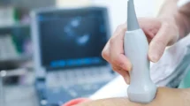 Exame de ecocardiograma bidimensional: entenda no detalhe