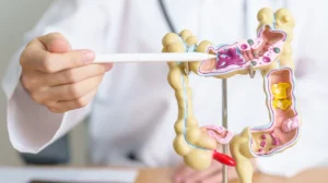 Câncer de intestino: guia completo com causas, exames e tratamentos